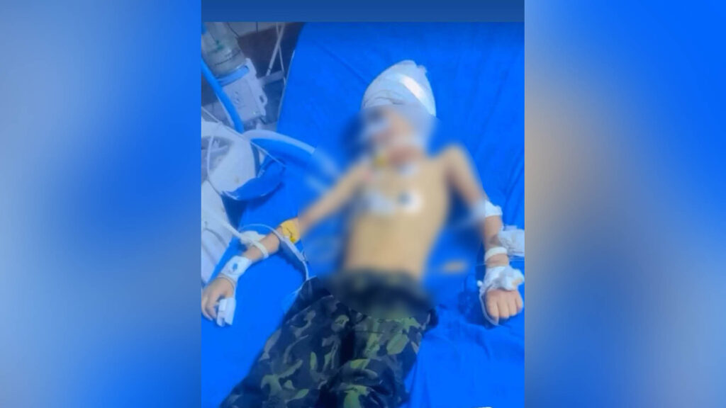 وفاة طفل من قضاء قلعة صالح إثر ضربة حصان أصابت رأسه