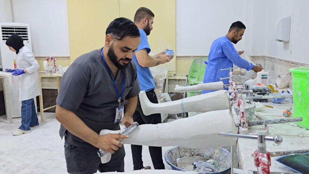 فوق الركبة وتحتها.. الموصل ترفع صناعة الأطراف الصناعية إلى 100 قطعة شهرياً