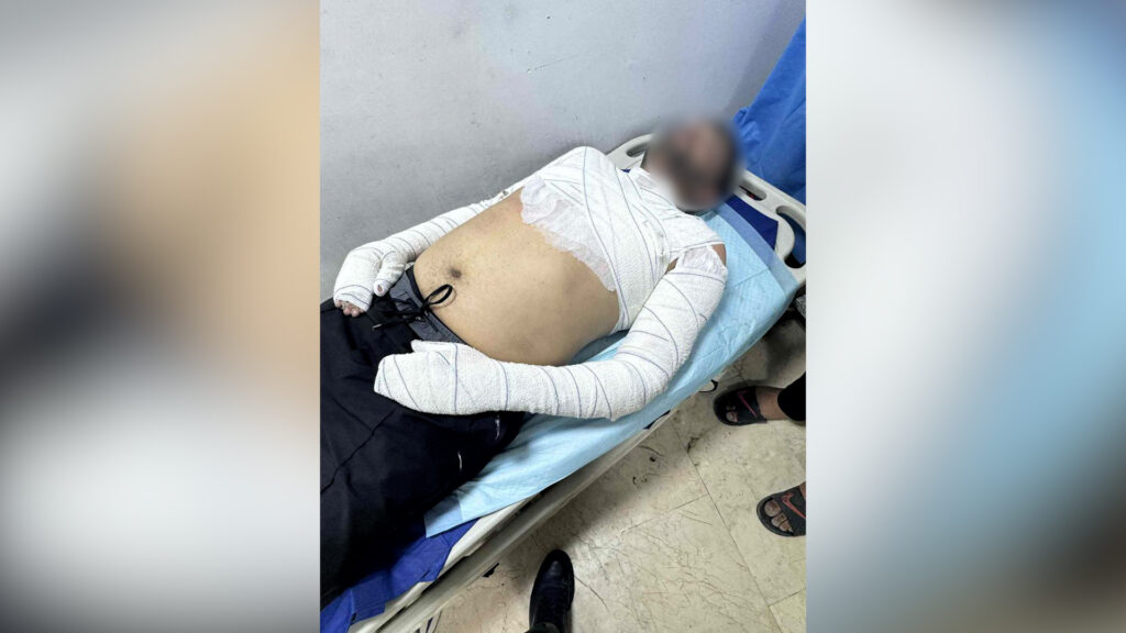 إحباط محاولة انتحار 3 أشقاء بالحرق وسط الكوت بعد نزاع على "كشك" للأطعمة